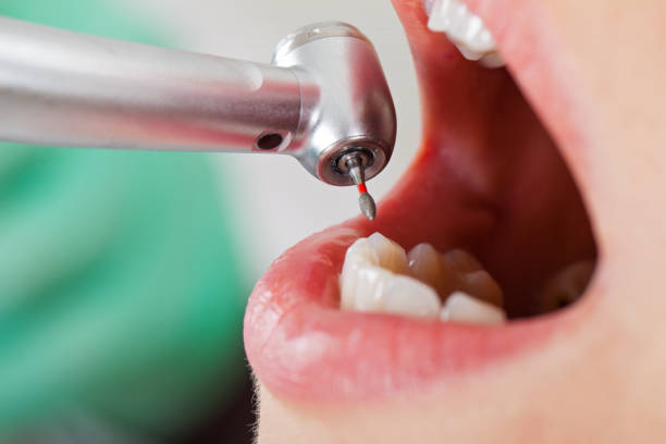 Best Knocked-Out Tooth Emergency  in Macon, GA